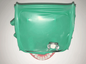 治療に使用するラバーダムの様子